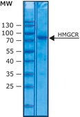 3-Hydroxy-3-methylglutaryl-CoA reductase human solution