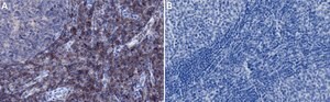 Anti-PI3-Kinase p85α Antibody, clone 3D12 ZooMAb&#174; Rabbit Monoclonal recombinant, expressed in HEK 293 cells