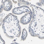 Anti-SLC1A2 antibody produced in rabbit Prestige Antibodies&#174; Powered by Atlas Antibodies, affinity isolated antibody, buffered aqueous glycerol solution