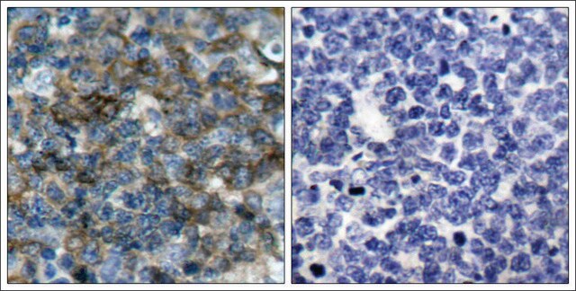 Anti-phospho-VASP (pSer157) antibody produced in rabbit affinity isolated antibody