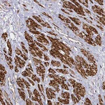 Anti-ZFP36L2 antibody produced in rabbit Prestige Antibodies&#174; Powered by Atlas Antibodies, affinity isolated antibody, buffered aqueous glycerol solution