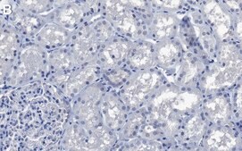 Anti-GSK3&#945; Antibody, clone 2J11 ZooMAb&#174; Rabbit Monoclonal recombinant, expressed in HEK 293 cells