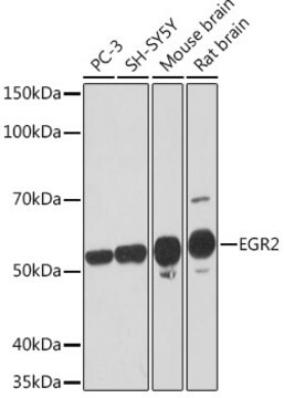 Anti-EGR2 Antibody, clone 1F6V7, Rabbit Monoclonal