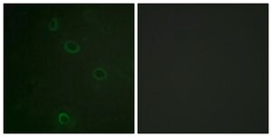 Anti-ATPASE antibody produced in rabbit affinity isolated antibody