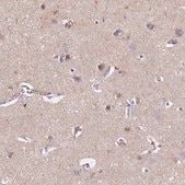 Anti-GABRD antibody produced in rabbit Prestige Antibodies&#174; Powered by Atlas Antibodies, affinity isolated antibody, buffered aqueous glycerol solution