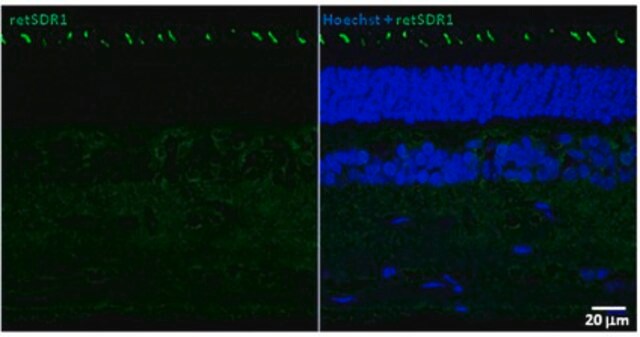 Anti-retSDR1 Antibody, clone A11 clone A11, from mouse