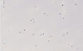 Anti-Collagen Type II Antibody, clone 1K11 ZooMAb&#174; Rabbit Monoclonal recombinant, expressed in HEK 293 cells