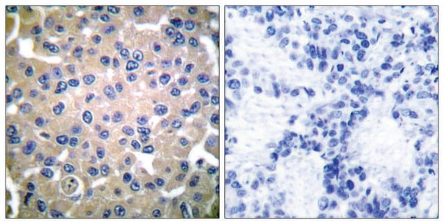 Anti-Transglutaminase 2, N-Terminal antibody produced in rabbit affinity isolated antibody