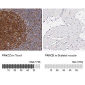 Anti-PRKCD antibody produced in rabbit Ab2, Prestige Antibodies&#174; Powered by Atlas Antibodies, affinity isolated antibody, buffered aqueous glycerol solution