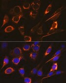 Anti-SFRP4 antibody produced in rabbit