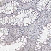 Anti-CA6 antibody produced in rabbit Prestige Antibodies&#174; Powered by Atlas Antibodies, affinity isolated antibody, buffered aqueous glycerol solution, ab2