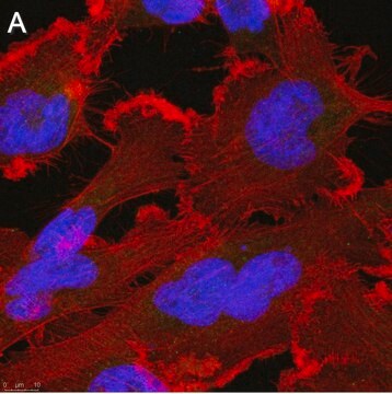 Anti-p62/SQSTM1 Antibody, clone 2D14 ZooMAb&#174; Rabbit Monoclonal recombinant, expressed in HEK 293 cells