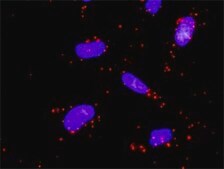Monoclonal Anti-MAP2K5 antibody produced in mouse clone 1E5, purified immunoglobulin, buffered aqueous solution