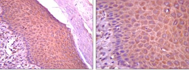 Anti-SOX1 Antibody from rabbit, purified by affinity chromatography