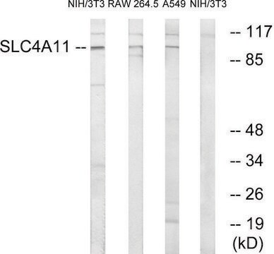 Anti-SLC4A11 antibody produced in rabbit affinity isolated antibody