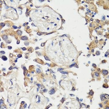 Anti-c-Fos antibody produced in rabbit