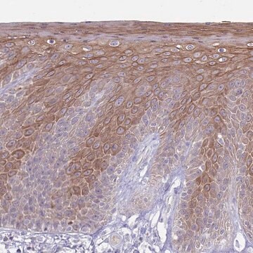 Anti-CDKN2B antibody produced in rabbit Prestige Antibodies&#174; Powered by Atlas Antibodies, affinity isolated antibody, buffered aqueous glycerol solution