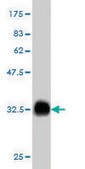 ANTI-FGR antibody produced in mouse clone 3F2, purified immunoglobulin, buffered aqueous solution
