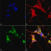 Monoclonal Anti-HCN4 antibody produced in mouse clone S114-10, 1&#160;mg/mL, purified immunoglobulin