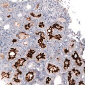 Monoclonal Anti-ACE2 antibody produced in mouse Prestige Antibodies&#174; Powered by Atlas Antibodies, clone CL4013, purified immunoglobulin