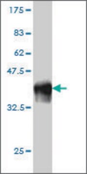 Monoclonal Anti-SCMH1 antibody produced in mouse clone 2D7, purified immunoglobulin, buffered aqueous solution