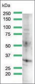 Anti-Cyclin D3 antibody, Rabbit monoclonal clone SP207, recombinant, expressed in proprietary host, affinity isolated antibody