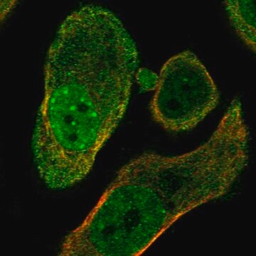 Anti-Parg Antibody Produced In Rabbit Prestige Antibodies&#174; Powered by Atlas Antibodies, affinity isolated antibody, buffered aqueous glycerol solution