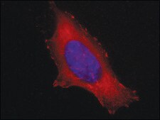 Anti-Vinculin antibody, Mouse monoclonal clone V284, purified from hybridoma cell culture