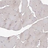 Anti-FAS antibody produced in rabbit Prestige Antibodies&#174; Powered by Atlas Antibodies, affinity isolated antibody, buffered aqueous glycerol solution