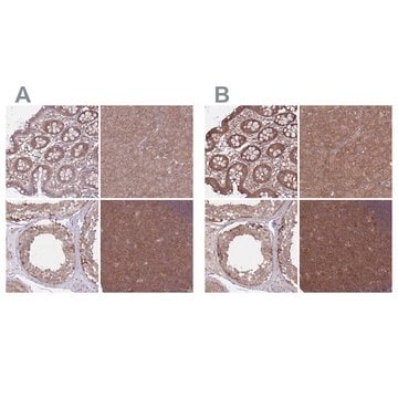 Anti-PFDN6 antibody produced in rabbit Prestige Antibodies&#174; Powered by Atlas Antibodies, affinity isolated antibody, buffered aqueous glycerol solution