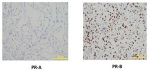 Anti-Progesterone Receptor B Antibody, clone 250/H11 clone 250/H11, from mouse