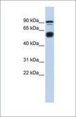 Anti-BCL11A antibody produced in rabbit affinity isolated antibody