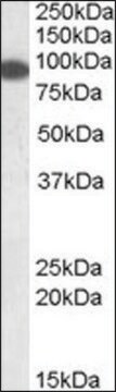 Anti-ERC1 (N-terminal) antibody produced in goat affinity isolated antibody, buffered aqueous solution