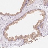 Anti-SOAT1 antibody produced in rabbit Prestige Antibodies&#174; Powered by Atlas Antibodies, affinity isolated antibody, buffered aqueous glycerol solution