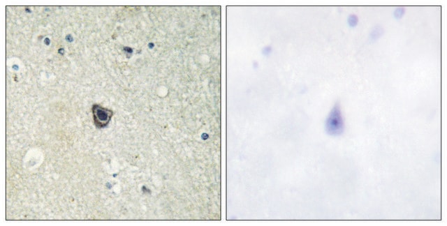 Anti-CSFR antibody produced in rabbit affinity isolated antibody