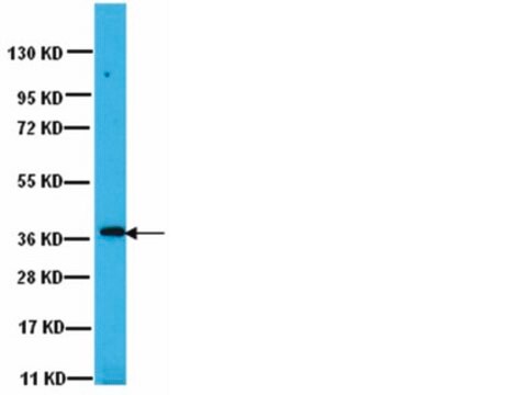 Anti-PP1&#947;1 Antibody Upstate&#174;, from rabbit