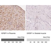 Anti-IGFBP1 antibody produced in rabbit Prestige Antibodies&#174; Powered by Atlas Antibodies, affinity isolated antibody, buffered aqueous glycerol solution