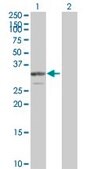 Anti-PDGFB antibody produced in mouse purified immunoglobulin, buffered aqueous solution
