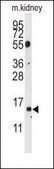 Anti-CDA (center) antibody produced in rabbit saturated ammonium sulfate (SAS) precipitated, buffered aqueous solution