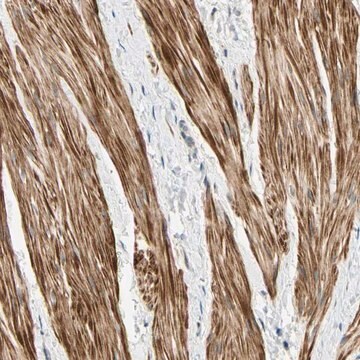 Anti-P4HA3 antibody produced in rabbit Prestige Antibodies&#174; Powered by Atlas Antibodies, affinity isolated antibody, buffered aqueous glycerol solution