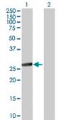 Anti-IKBKB antibody produced in mouse purified immunoglobulin, buffered aqueous solution