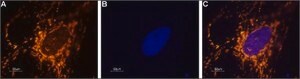 Anti-Sodium Channel, Brain Type I (&#945; subunit) antibody produced in rabbit affinity isolated antibody, lyophilized powder