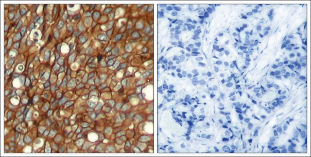 Anti-phospho-ERBB2 (pTyr1248) antibody produced in rabbit affinity isolated antibody