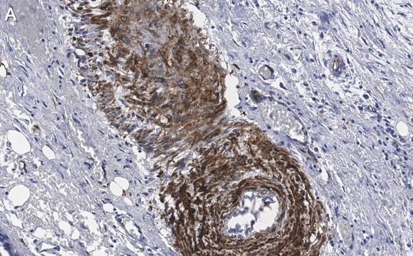 Anti-phospho-HSP27 Ser82 Antibody, clone 1O17 ZooMAb&#174; Rabbit Monoclonal recombinant, expressed in HEK 293 cells