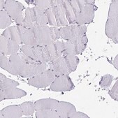 Anti-PLA2G1B antibody produced in rabbit Prestige Antibodies&#174; Powered by Atlas Antibodies, affinity isolated antibody, buffered aqueous glycerol solution