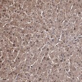 Anti-GSTO1 antibody produced in rabbit Prestige Antibodies&#174; Powered by Atlas Antibodies, affinity isolated antibody, buffered aqueous glycerol solution