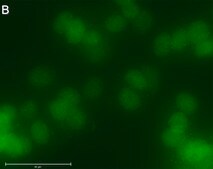 Anti-RAR&#947;1 Antibody, clone 1C22 ZooMAb&#174; Rabbit Monoclonal recombinant, expressed in HEK 293 cells