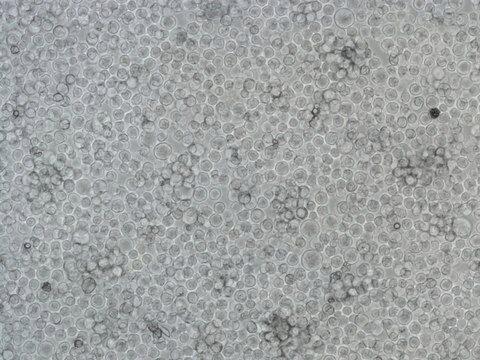 K562 Cell line human 89121407, from human blood(chronic myelogenous leukemia)