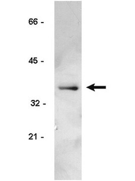 Anti-Cyclin D1/2 Antibody, clone 5D4 clone 5D4, Upstate&#174;, from mouse