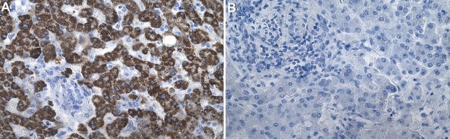 Anti-SREBP1 Antibody, clone 2D21 ZooMAb&#174; Rabbit Monoclonal recombinant, expressed in HEK 293 cells